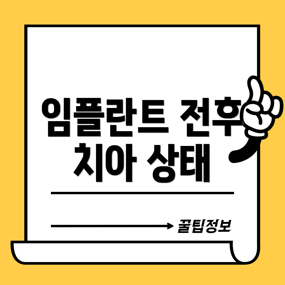 임플란트 전후 치아 상태